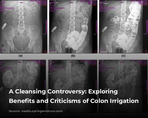 A Cleansing Controversy: Exploring the Benefits and Criticisms of Colon Irrigation